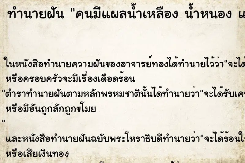 ทำนายฝัน คนมีแผลน้ำเหลือง น้ำหนอง แผลเต็มตัว ทำนายฝัน คนมีแผลน้ำเหลือง น้ำหนอง แผลเต็มตัว